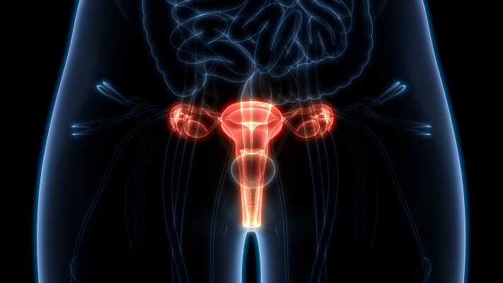 Ectropión Cervical