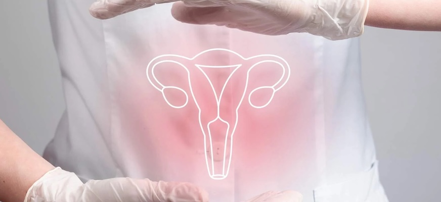 cáncer de cuello uterino